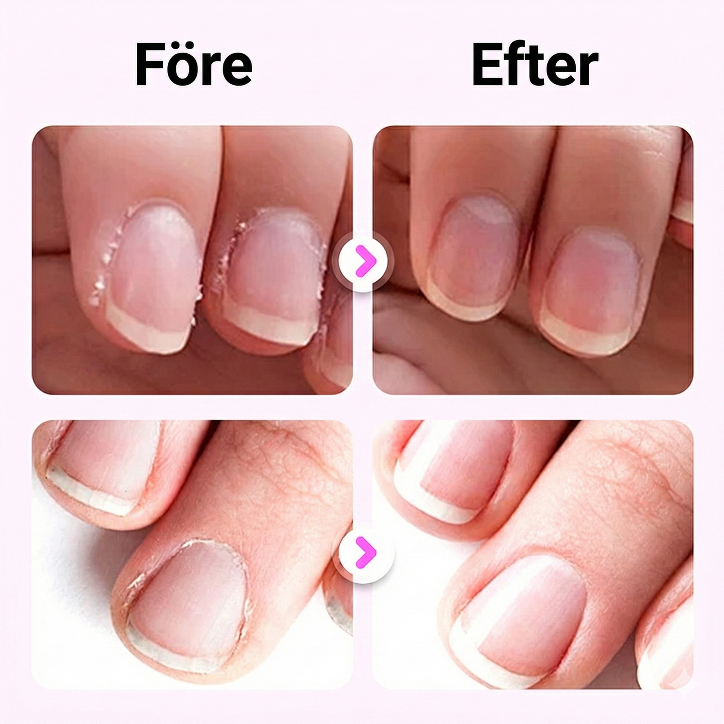3-i-1 Nagelpenna med Kameliaolja – Vårdar Nagelband & Reparerar Skador